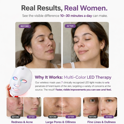 SkinLift LED Mask